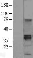 ls007479 wnt8b human over expression lysates nm 003393 wb testing 1