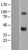 WNT11 Human Over-expression Lysates NM_004626