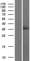 WNT2B Human Over-expression Lysates NM_004185