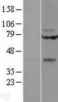 WNT9A Human Over-expression Lysates NM_003395