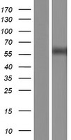 ls007490 wilms tumor protein wt1 human over expression lysates nm 024425 wb testing 2