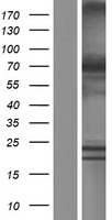 XPNPEP1 Human Over-expression Lysates NM_001167604