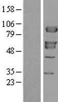 XRCC1 Human Over-expression Lysates NM_006297