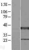 ls007517 xrcc3 human over expression lysates nm 005432 wb testing 2
