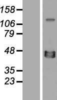 XRCC4 Human Over-expression Lysates NM_003401