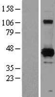 XRCC4 Human Over-expression Lysates NM_022550