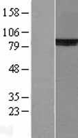 Ku80 (XRCC5) Human Over-expression Lysates NM_021141