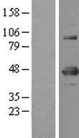YY1 Human Over-expression Lysates NM_003403