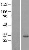 14-3-3 beta (YWHAB) Human Over-expression Lysates NM_003404
