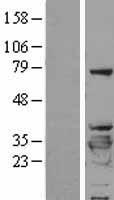 14-3-3 beta (YWHAB) Human Over-expression Lysates NM_139323