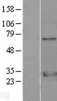 14-3-3 zeta (YWHAZ) Human Over-expression Lysates NM_001135699