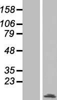splicing factor 1 (SF1) Human Over-expression Lysates NM_201997