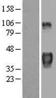 Tristetraprolin (ZFP36) Human Over-expression Lysates NM_003407
