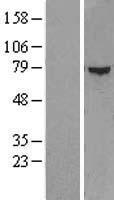 ZFP37 Human Over-expression Lysates NM_003408