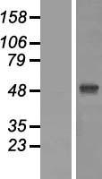 ZIC1 Human Over-expression Lysates NM_003412