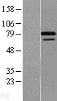 ZNF8 Human Over-expression Lysates NM_021089