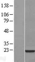 ls007555 cnbp human over expression lysates nm 003418 wb testing 2