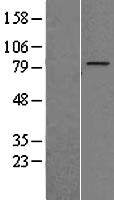 ZNF16 Human Over-expression Lysates NM_001029976