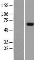 ZNF18 Human Over-expression Lysates NM_144680