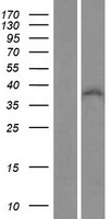 ls007580 znf32 human over expression lysates nm 006973 wb testing 1