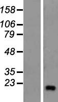 ZNF69 Human Over-expression Lysates NM_021915