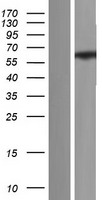 ls007626 znf75 znf75d human over expression lysates nm 001185063 wb testing 1