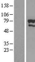 ZNF76 Human Over-expression Lysates NM_003427