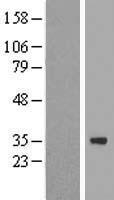 ZNF124 Human Over-expression Lysates NM_003431