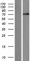 ZNF131 Human Over-expression Lysates NM_003432