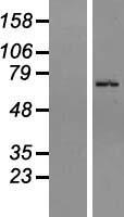 ZNF133 Human Over-expression Lysates NM_001083330