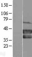 Mel18 (PCGF2) Human Over-expression Lysates NM_007144