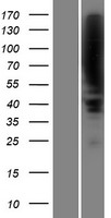 ls007704 plzf zbtb16 human over expression lysates nm 006006 wb testing 1