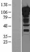 ZNF148 Human Over-expression Lysates NM_021964