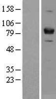 Miz1 (ZBTB17) Human Over-expression Lysates NM_003443