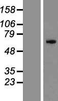 ZNF155 Human Over-expression Lysates NM_198089