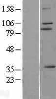 ZNF175 Human Over-expression Lysates NM_007147