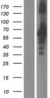 ls007739 znf185 human over expression lysates nm 001178113 wb testing 2