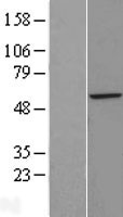 ZFP200 (ZNF200) Human Over-expression Lysates NM_003454