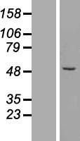 ZFP200 (ZNF200) Human Over-expression Lysates NM_198087