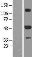 ZNF213 Human Over-expression Lysates NM_001134655