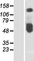 ZnT1 (SLC30A1) Human Over-expression Lysates NM_021194
