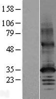 ls007780 slc30a2 human over expression lysates nm 032513 wb testing 2