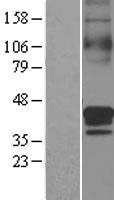 SLC30A3 Human Over-expression Lysates NM_003459