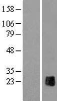 ls007783 zp2 human over expression lysates nm 003460 wb testing 1