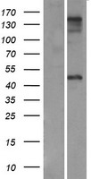 ls007784 zp3 human over expression lysates nm 007155 wb testing 2