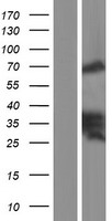 ls007791 zyxin zyx human over expression lysates nm 003461 wb testing 1