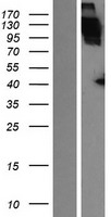 ApoER2 (LRP8) Human Over-expression Lysates NM_001018054