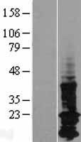 LAPTM5 Human Over-expression Lysates NM_006762