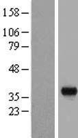 BSND Human Over-expression Lysates NM_057176
