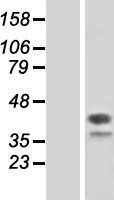 DAP3 Human Over-expression Lysates NM_004632